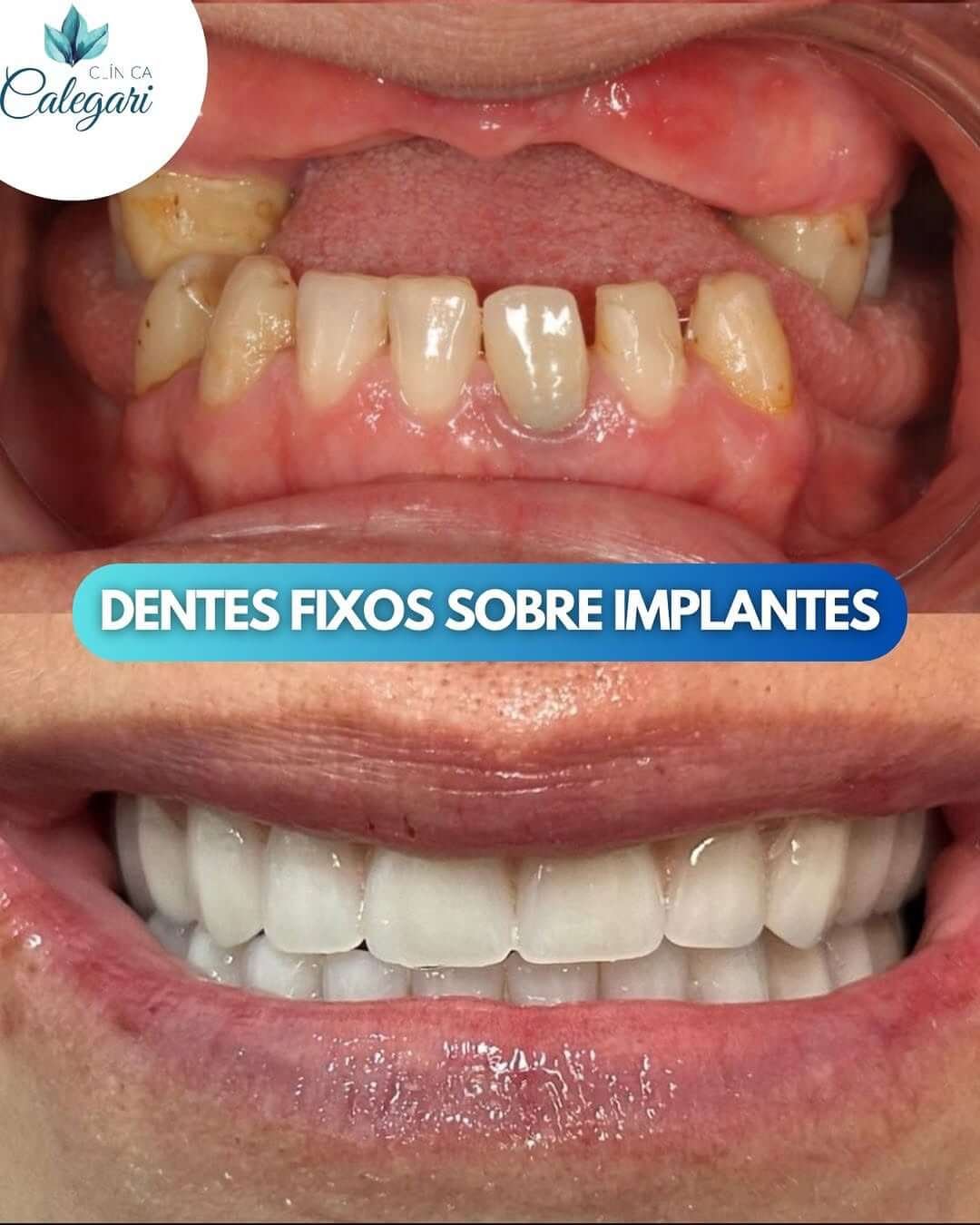 snapinsta.com .br 69d3c771bbcce